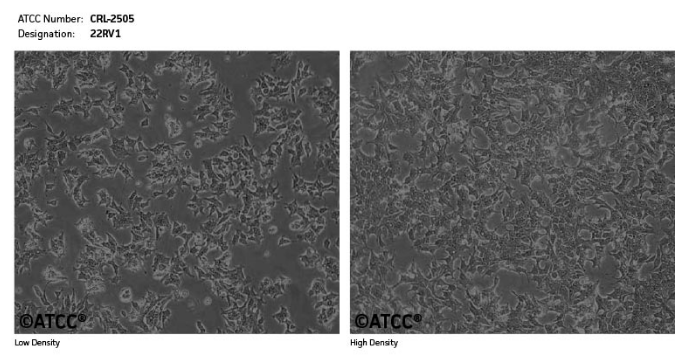 22RV1细胞ATCC官网图片