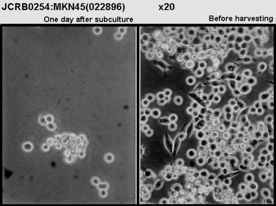 MKN-45细胞显微镜图