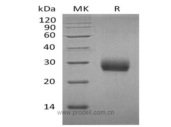 Procell-RANK/ TNFRSF11A/ CD265 (C-6His), Mouse, Recombinant