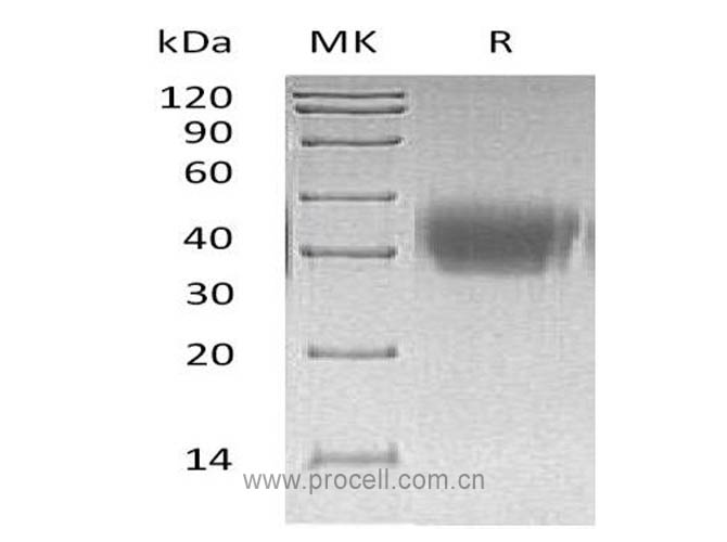 Procell-ACVR2A (C-6His), Human, Recombinant