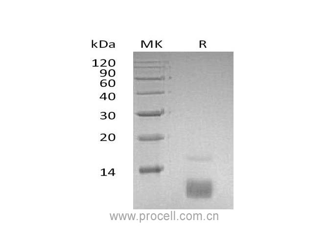 Procell-RANTES/ CCL5, Human, Recombinant