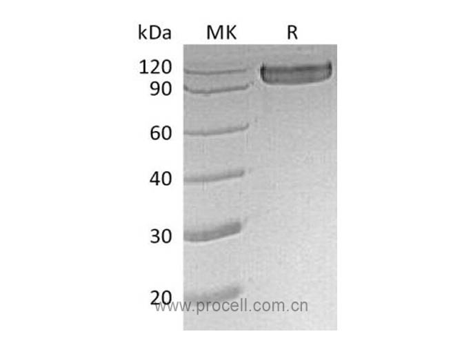 Procell-CD30/ TNFRSF8 (C-Fc), Human, Recombinant