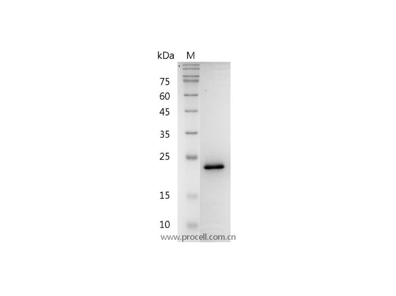 FGF-8a/AIGF/HBGF-8, Human, Rcombinant