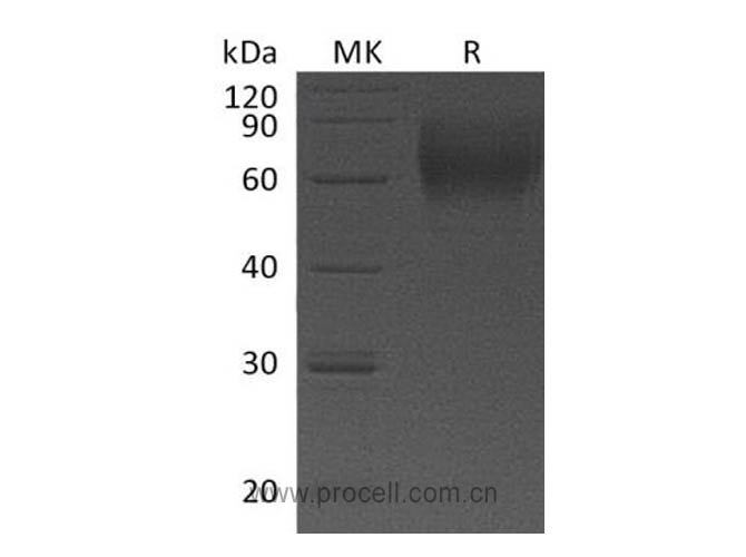 Procell-IL-23R (C-6His), Human, Recombinant