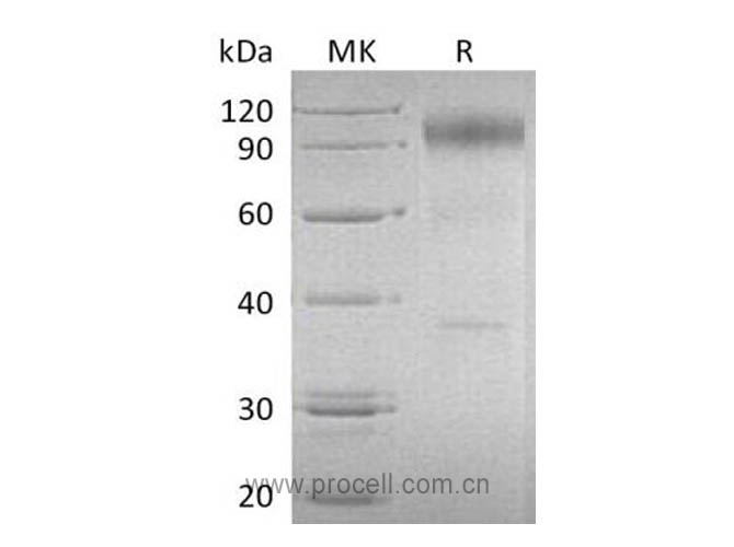 Procell-IL-23R (C-Fc), Human, Recombinant