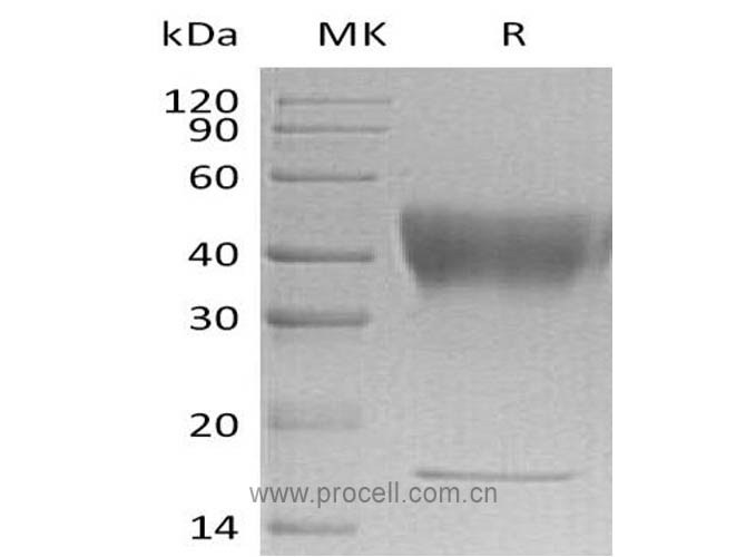 Procell-IFNGR1/ CD119, Human, Recombinant