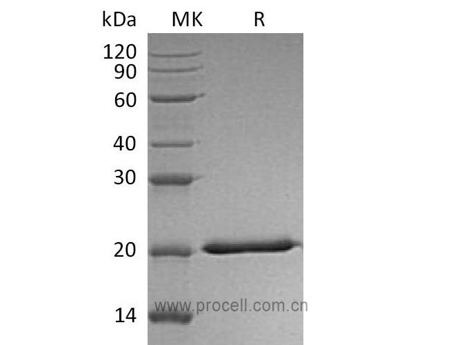 IFN-λ2/ IL-28A (C-6His), Human, Recombinant
