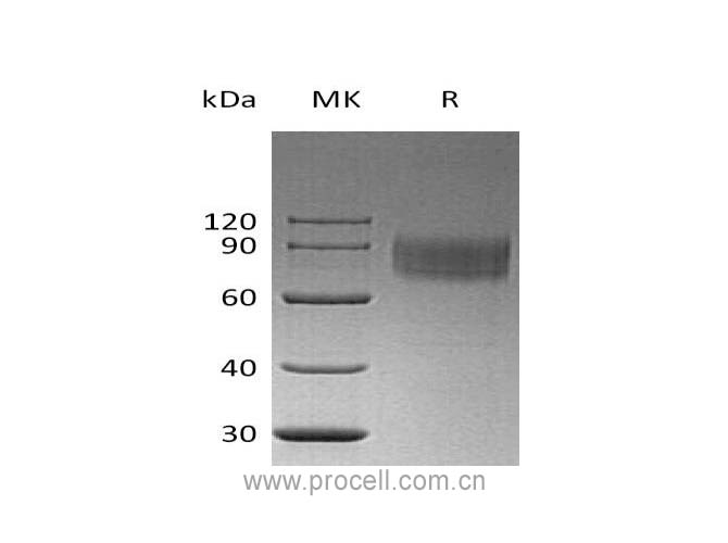 Procell-IFNAR1 (C-6His), Human, Recombinant