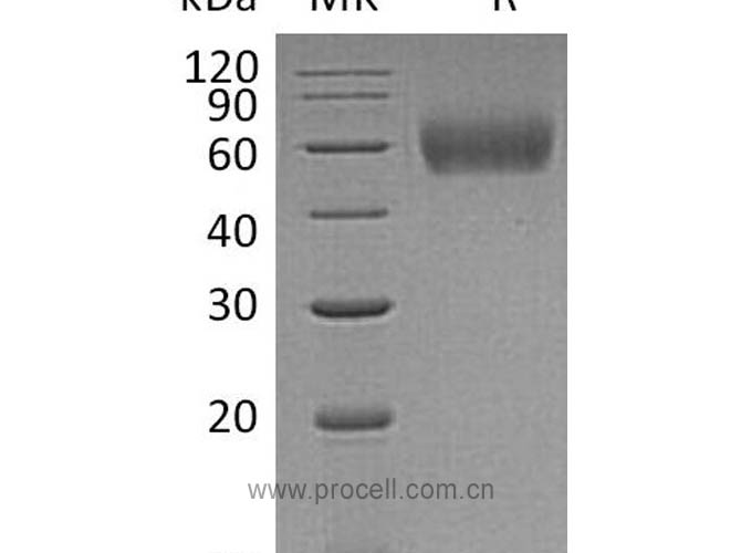 IL-1R-2/ CD121b, Human, Recombinant