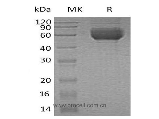 Procell-ST2/ IL1RL1, Human, Recombinant