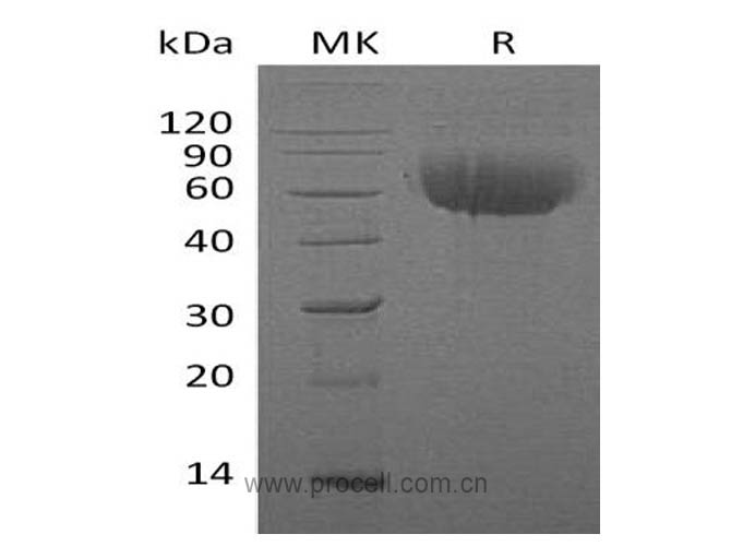 Procell-IL-13RA1/ IL13RA, Human, Recombinant