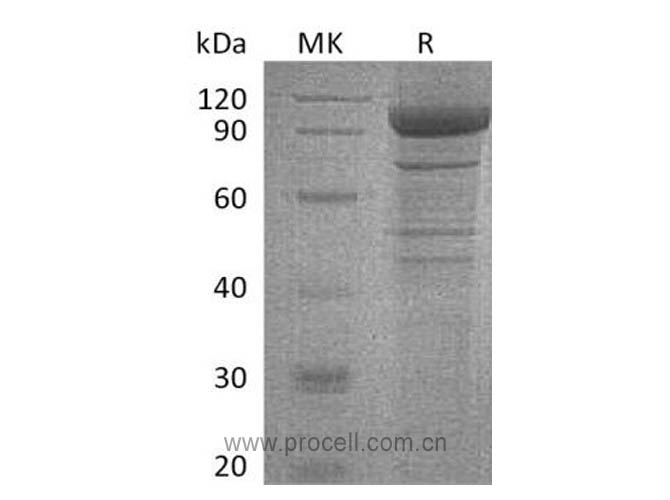 Procell-IL-35, Human, Recombinant