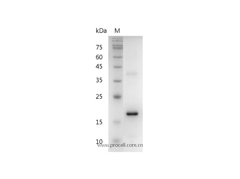 IL-37/IL-1F7/IL-1H4, Human, Recombinant