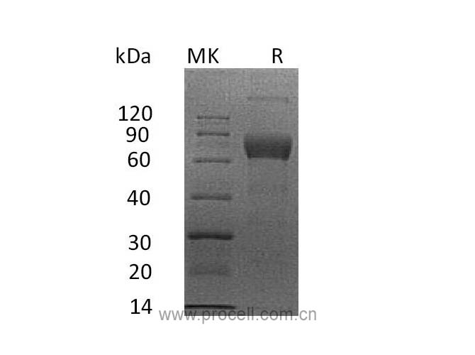 IL-4Rα/ CD124 (C-mFc), Human, Recombinant