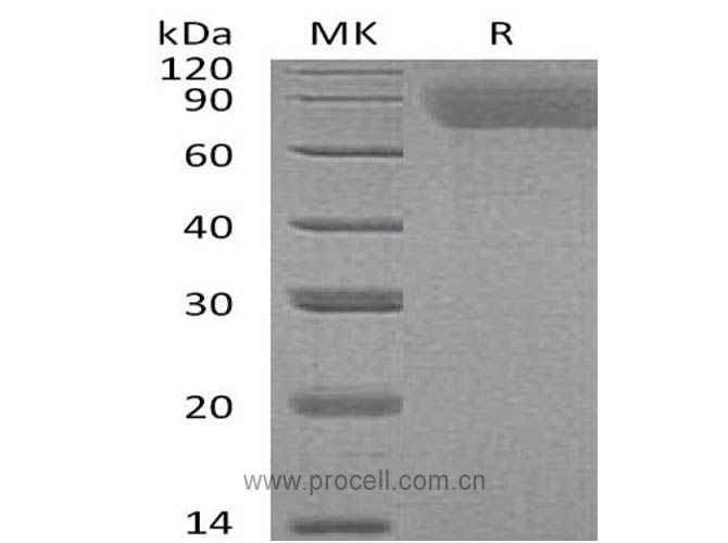 Procell-TPO/ THPO (N, C-6His), Human, Recombinant