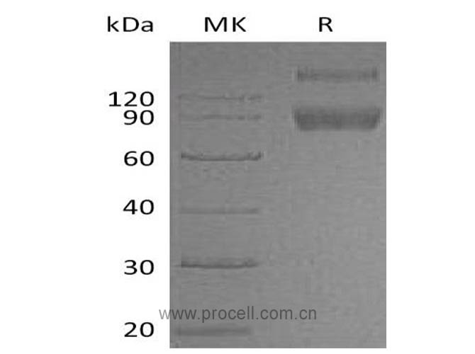 Procell-IL-1R-2/ CD121b (C-Fc), Mouse, Recombinant
