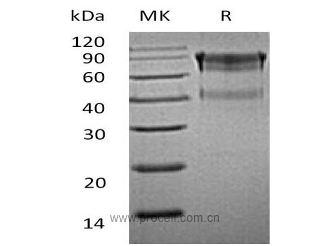 IL-15RA/ CD215 (C-Fc), Mouse, Recombinant
