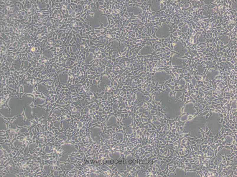 293A (人胚肾细胞) (STR鉴定正确)