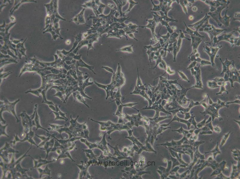 22RV1 (人前列腺癌细胞) (STR鉴定正确)