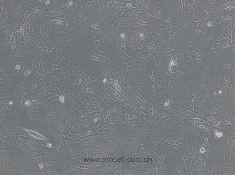 3T3-L1 (小鼠胚胎成纤维细胞) (STR鉴定正确)