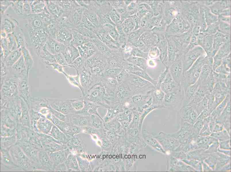 769-P (人肾细胞腺癌细胞) (STR鉴定正确)