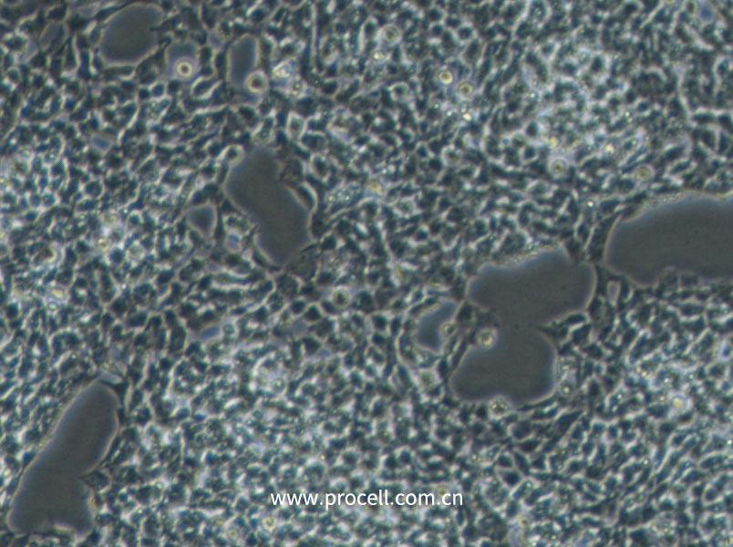A-673 (人横纹肌肉瘤细胞) (STR鉴定正确)