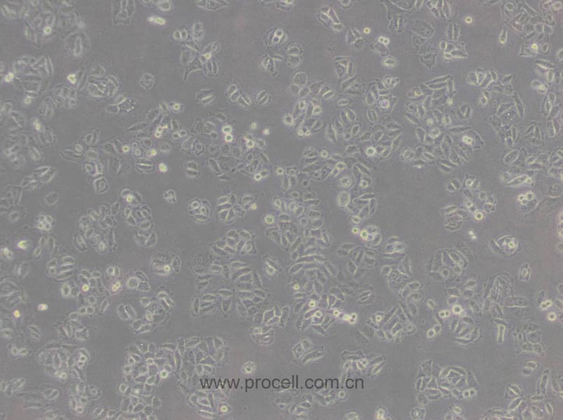 Acc-2 (人涎腺腺样囊性癌细胞) (Hela污染细胞系，暂不供应)