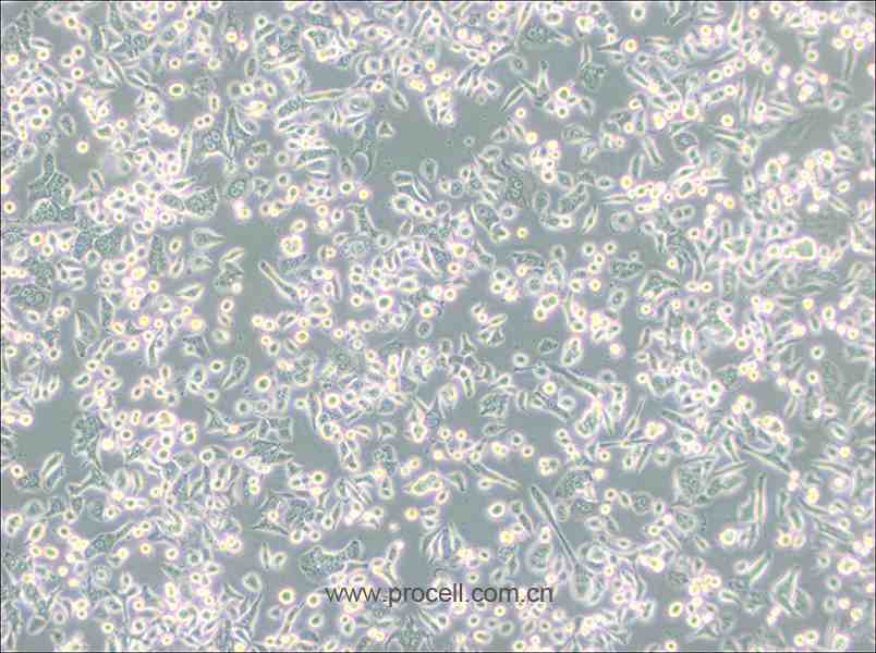 AsPC-1 (人转移胰腺腺癌细胞) (STR鉴定正确)