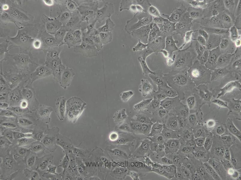 DU 145 (人前列腺癌细胞) (STR鉴定正确)