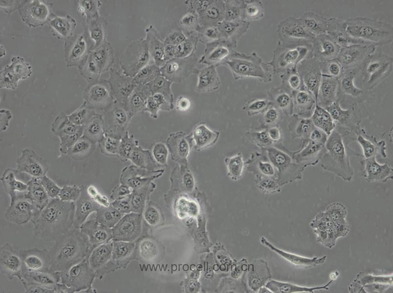 DU 145 (人前列腺癌细胞) (STR鉴定正确)