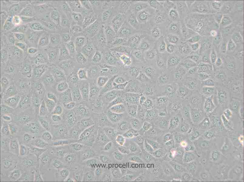 WB-F344 (大鼠肝上皮样干细胞) (种属鉴定正确)