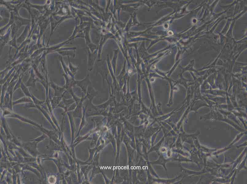 HBZY-1 (大鼠肾小球系膜细胞) (种属鉴定正确)