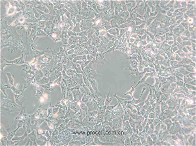 HCC827 (人非小细胞肺癌细胞) (STR鉴定正确)