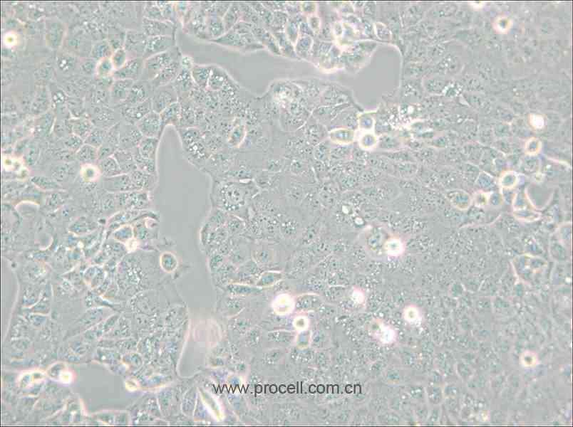 HEC-1-A (人子宫内膜腺癌细胞) (STR鉴定正确)