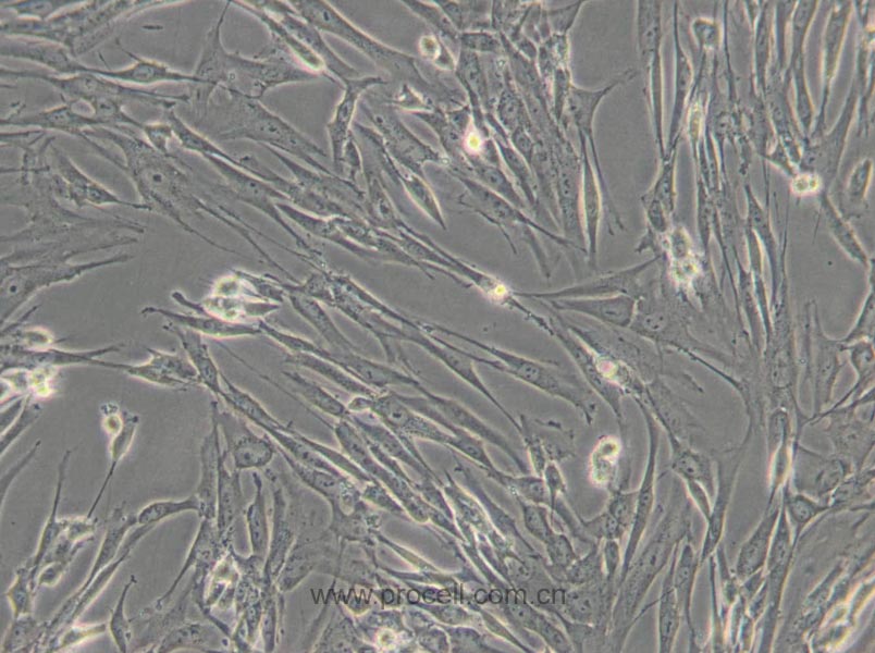 HFL1 (人胚肺成纤维细胞) (STR鉴定正确)