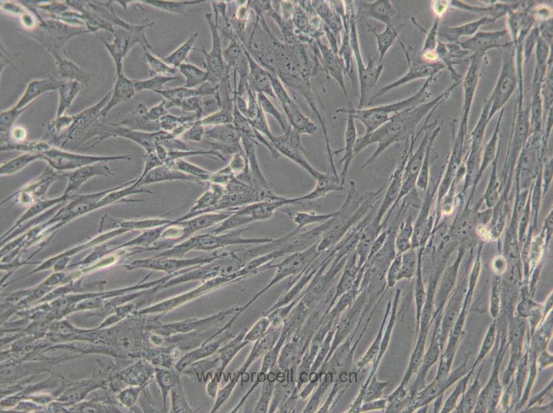 HFL1 (人胚肺成纤维细胞) (STR鉴定正确)