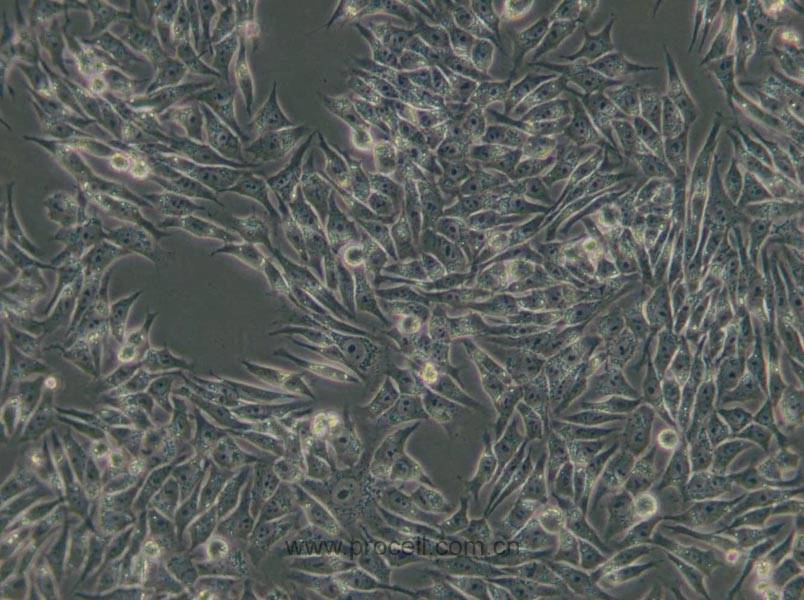 HGC-27 (人胃癌细胞(未分化)) (STR鉴定正确)