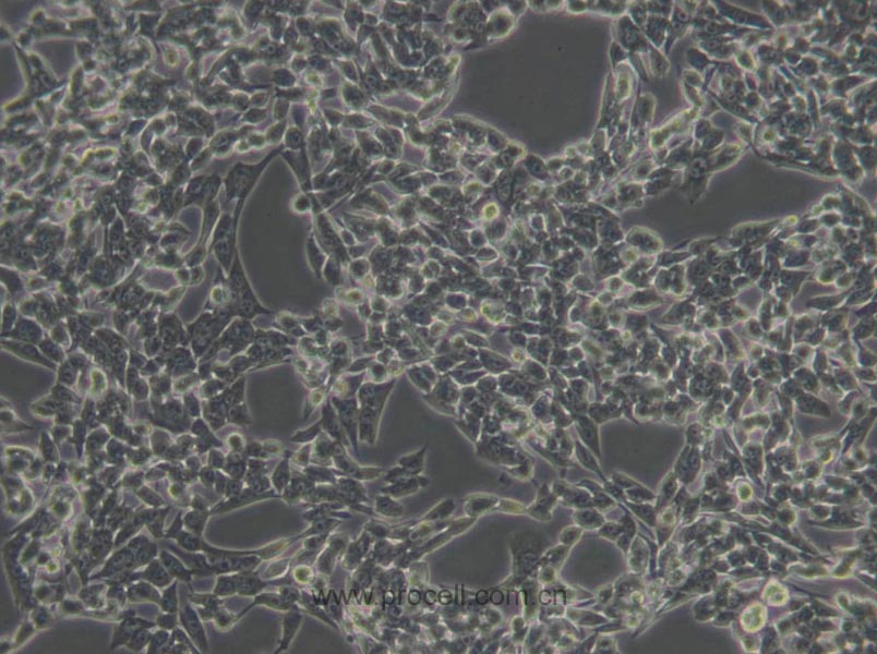 HSC-T6 (大鼠肝星形细胞) (种属鉴定正确)