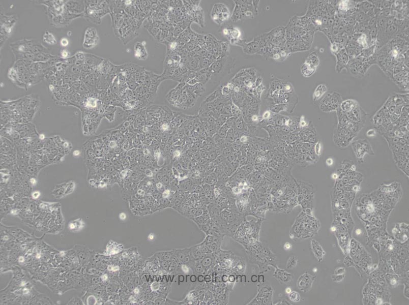 JEG-3 (人绒毛膜癌细胞) (STR鉴定正确)