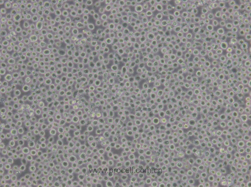 K-562 [K562] (人慢性髓原白血病细胞) (STR鉴定正确)