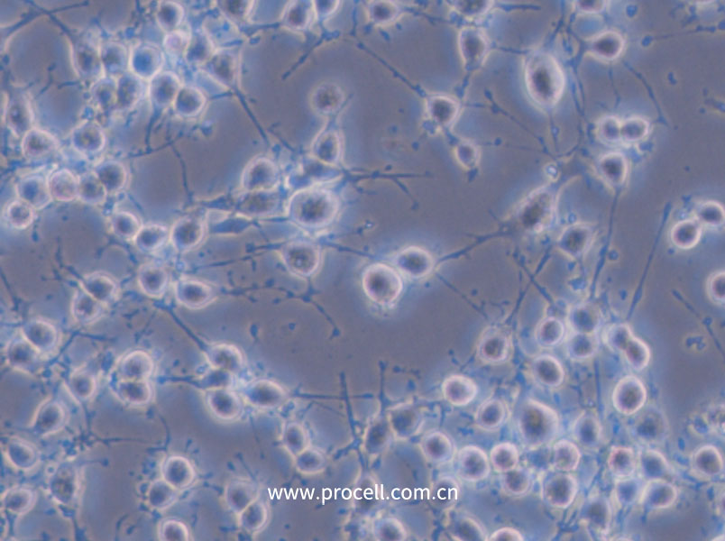 MADB106 (大鼠乳腺癌细胞) (种属鉴定正确)