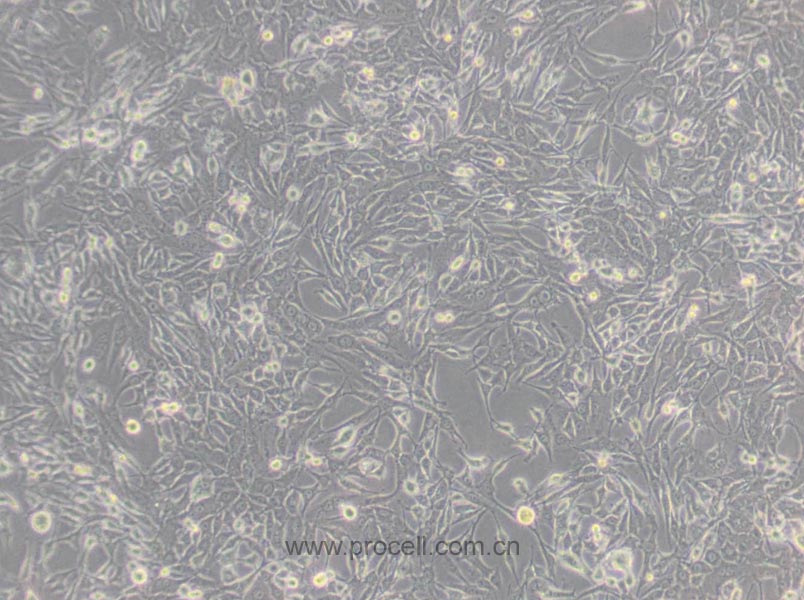 MDA-MB-435S (人乳腺癌细胞/人黑素瘤细胞) (M14污染细胞系，暂不供应)