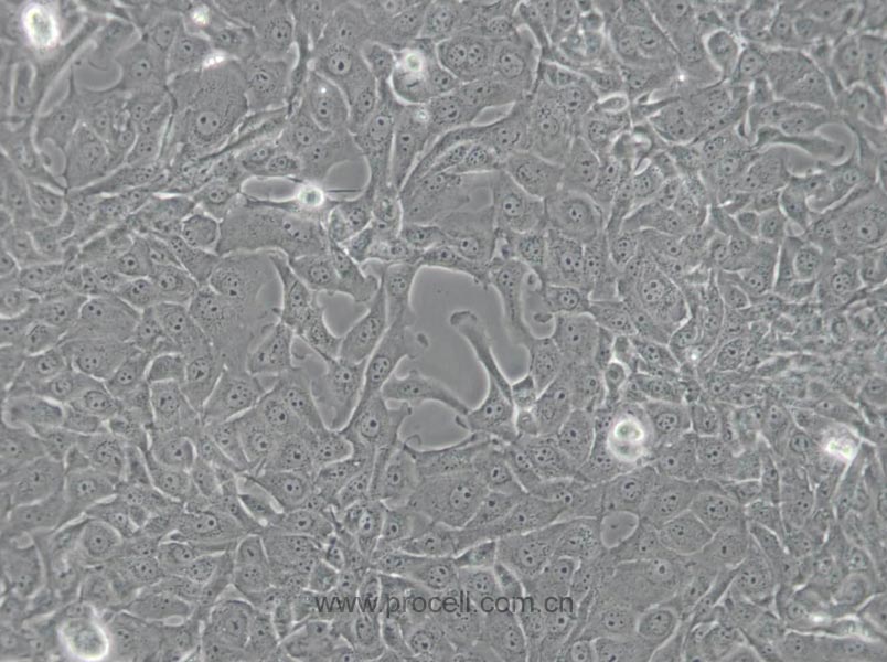 MDBK [NBL-1] (牛肾细胞)(种属鉴定正确)