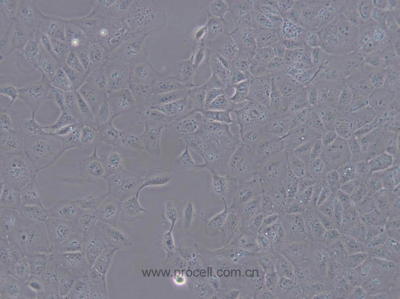 MDCK [NBL-2] (犬肾细胞) (种属鉴定正确)