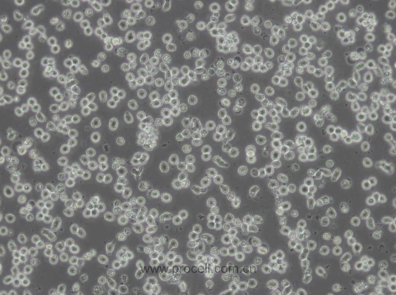 MOLT-4 (人急性淋巴母细胞白血病细胞) (STR鉴定正确)