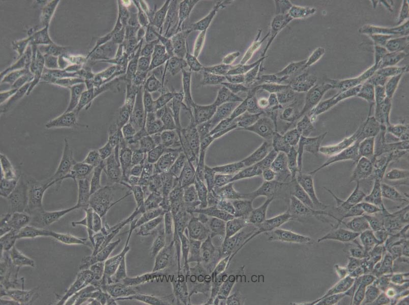 NIH/3T3 (小鼠胚胎细胞) (STR鉴定正确)