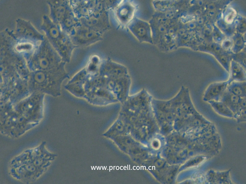 NCI-H1395 (人肺腺癌细胞) (STR鉴定正确)