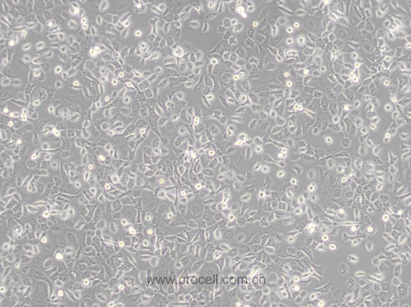 HCC 94 [HCC941122] (人子宫鳞癌细胞(高分化)) (STR鉴定正确)