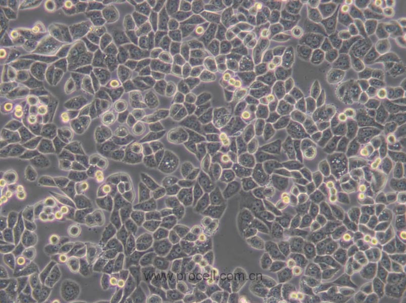 MDA-MB-468 (人乳腺癌细胞) (STR鉴定正确)