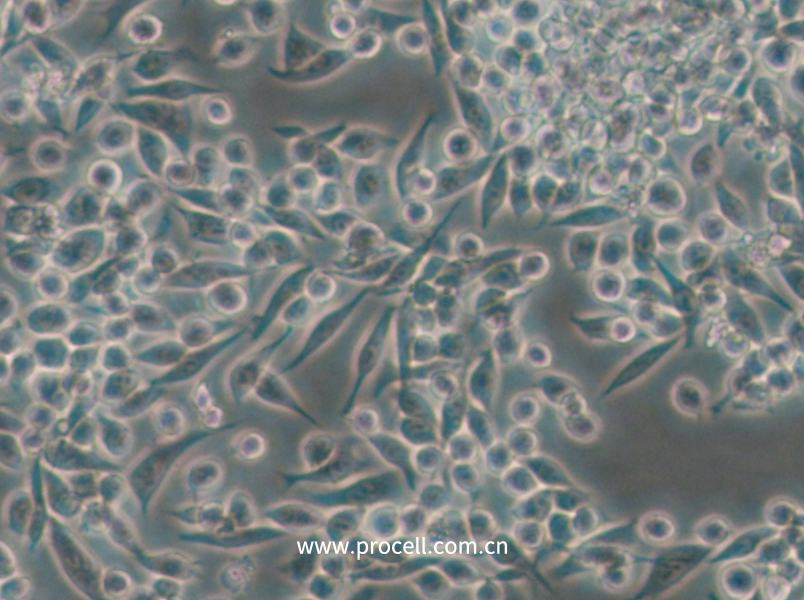 MKN-45 (人胃癌细胞)(STR鉴定正确）